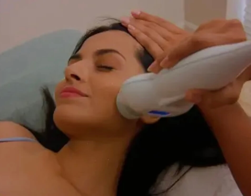 cryofacial stock