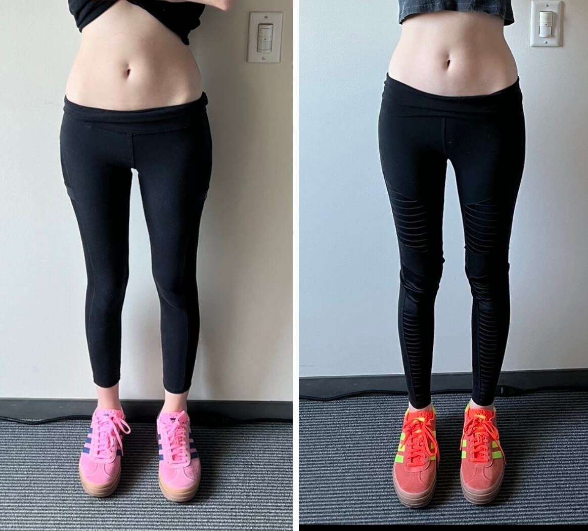 cryoslim b_a abs