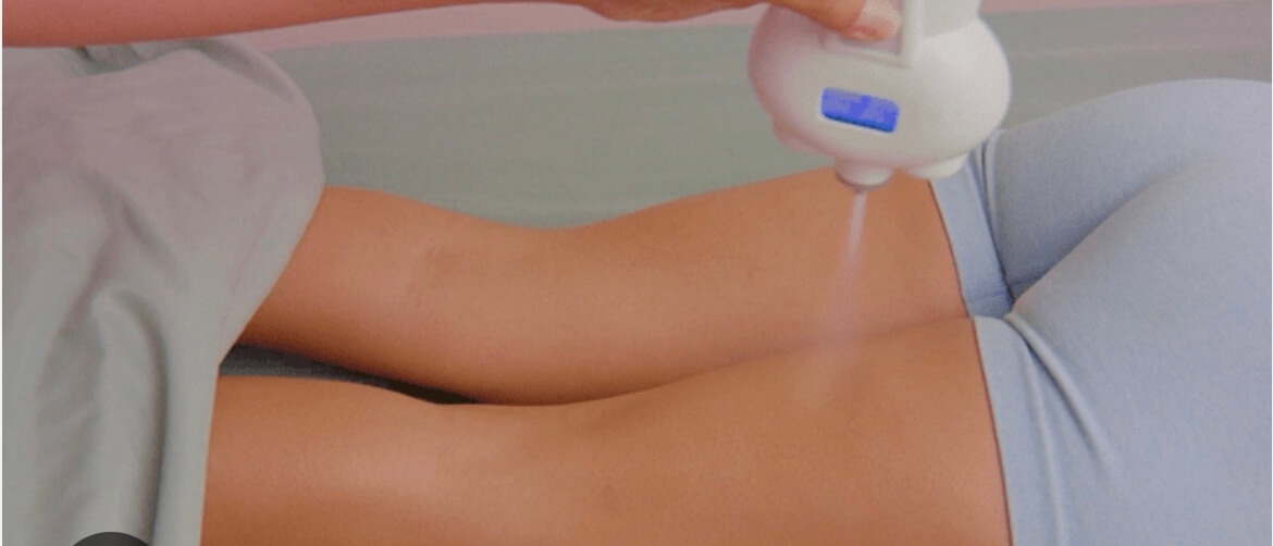 cryoslim hamstring stock